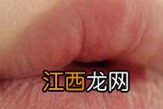 嘴唇上面抠破了怎幺办 小心感染危及生命