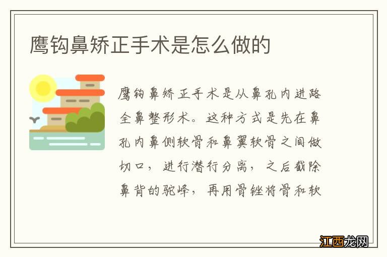 鹰钩鼻矫正手术是怎么做的