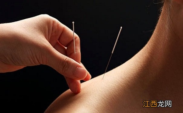 针灸减肥的好处是什么?哪些人适合用针灸减肥法?