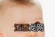 孩子眼睛老眨是怎么回事