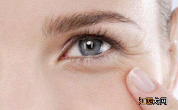 怎么样去掉鱼尾纹?如何有效去除鱼尾纹?