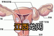 影响铁吸收的因素