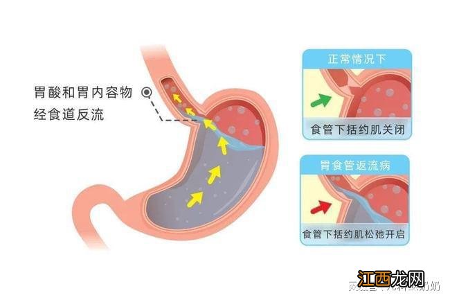 孩子白天不咳晚上咳，7大原因6个对策，照着做就对了