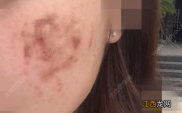 伪劣化妆品让多名大学生惨遭毁容,怎么分辨伪劣化妆品?