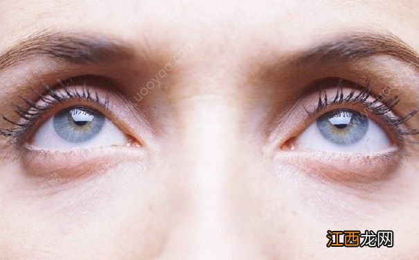 祛除眼袋有哪些好办法?哪些方法能够有效祛除眼袋?