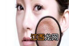 女儿胖瘦随妈妈，肥胖会遗传吗？