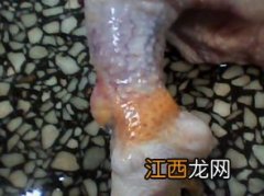 斗鸡腿关节肿是什么病