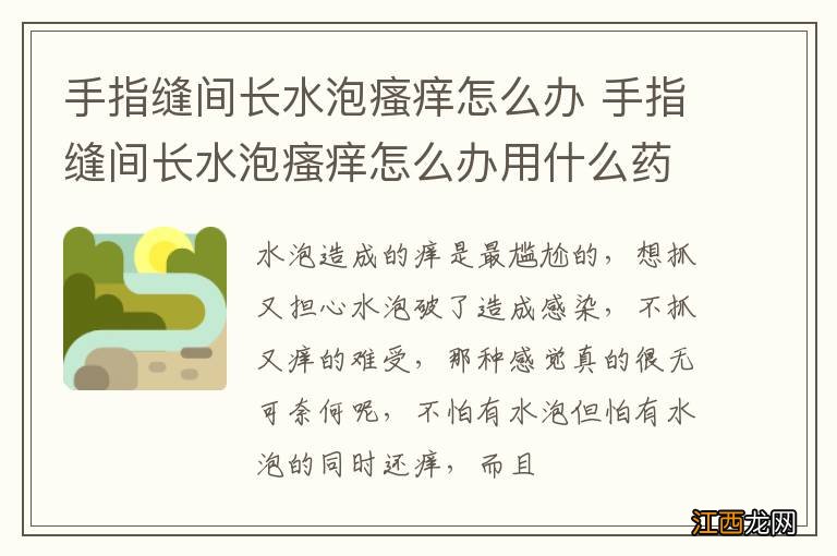 手指缝间长水泡瘙痒怎么办 手指缝间长水泡瘙痒怎么办用什么药