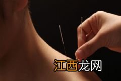 针灸减肥疗法有什么特点？针灸减肥疗法适宜哪些人群？