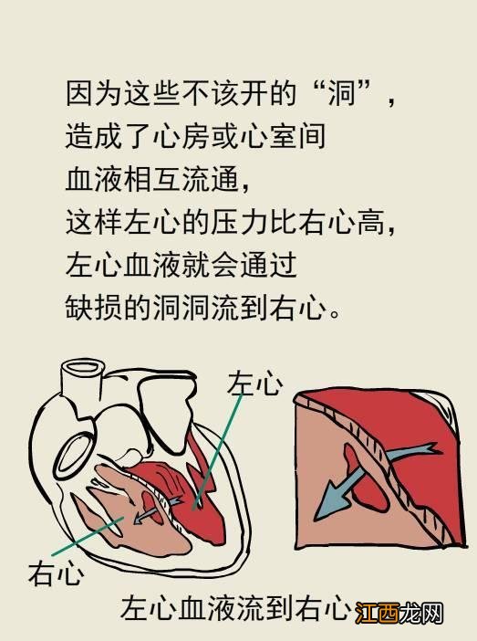 心脏病儿童能买保险吗？