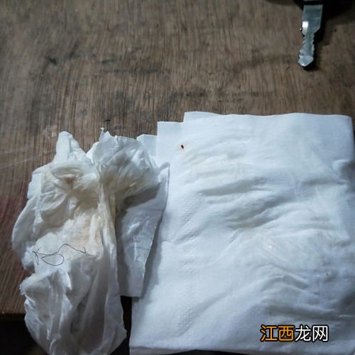 月经提前一周有褐色分泌物是怀孕吗-月经提前一周有褐色分泌物肚子疼怎么回事