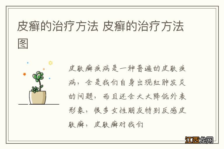 皮癣的治疗方法 皮癣的治疗方法图