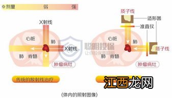 所有癌症都可以用质子重离子医疗险吗？