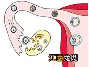 输卵管堵塞治疗可以报保险吗？