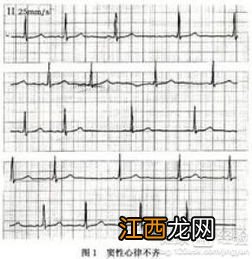 三岁宝宝窦性心律不齐买保险会被拒吗？