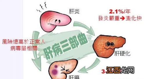 长期饮酒吃腌腊食品易诱发肝癌吗-为什么肝癌治好了也活不长