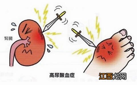 十二指肠溃疡可以买重疾险吗?