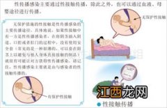 和艾滋病人睡了一年没有感染-女朋友艾滋三年了我咋没有