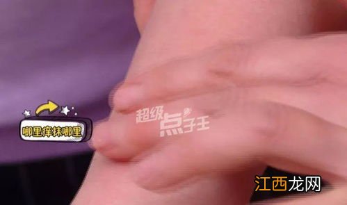 削芋头手痒多久才不痒-芋头手痒会过敏吗