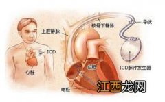 窦性心动过速10年居然未吃药-窦性心动过速会自愈吗