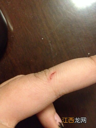 狗咬了怎么处理伤口不用打针-让狗牙蹭破一点皮没事吧