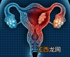 感染hpv能和女儿睡一张床吗-酒店裸睡会不会感染hpv