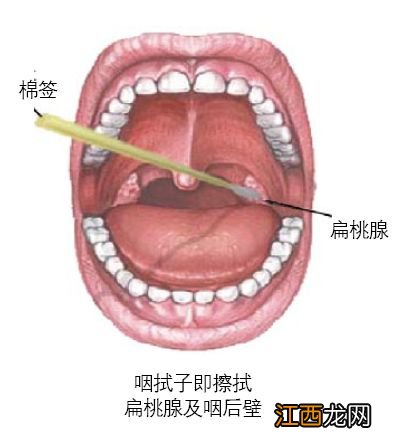 核酸检测是外科还是内科-核酸检测是外科吗