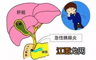 得了胰腺炎后要一辈子忌口吗-急性胰腺炎终身戒酒吗