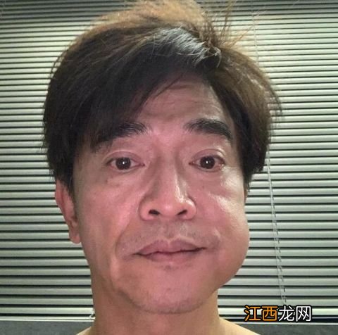 拔牙后脸一直肿好几天是正常的吗-拔牙后脸肿要第几天开始消肿