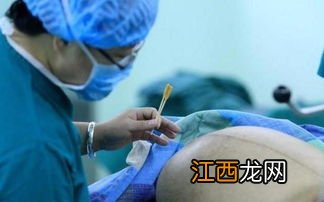 剖腹产四胎成功率高吗-剖腹产四胎医院接受吗