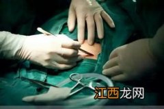 剖腹产四胎成功率高吗-剖腹产四胎医院接受吗