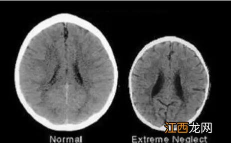 为啥孩子被吼后不说话,还反过来求抱抱,知道真相后你还敢吼吗?