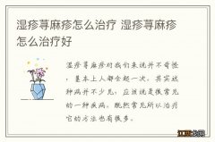 湿疹荨麻疹怎么治疗 湿疹荨麻疹怎么治疗好