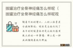 拔罐治疗坐骨神经痛怎么样呢视频 拔罐治疗坐骨神经痛怎么样呢