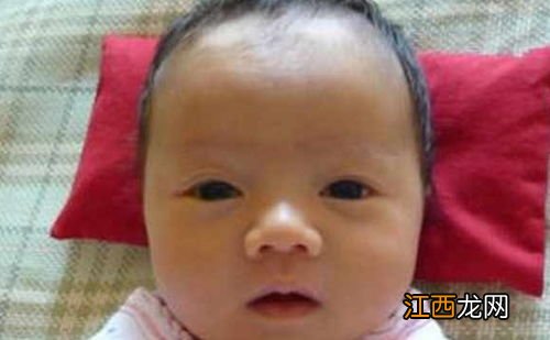 宝宝黄疸晒太阳有用吗-宝宝晒黄疸几点的太阳好呀