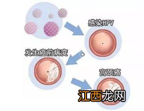 hpv16阳性还能上保险吗？