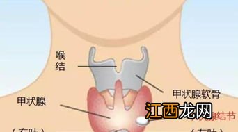 甲状腺结节买重疾有限制吗？