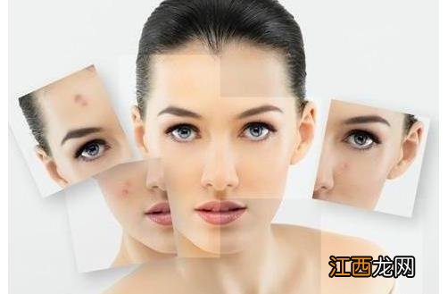 哪种手段治疗痘坑更有效呢?