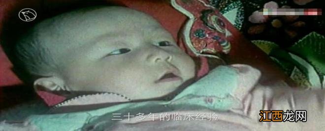 34年前，我国第一例试管婴儿成功后，孩子后来怎么样了？