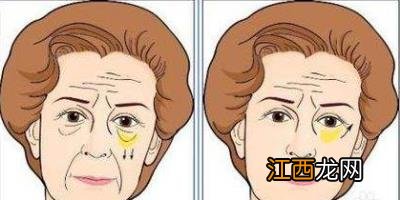 北京彤美整形医院刘风卓眼整形怎么样