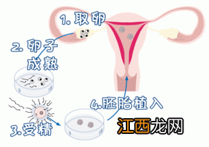 什么叫试管婴儿 试管婴儿的解释