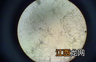 放线菌的繁殖方式，放线菌是原核生物吗