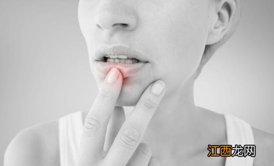 冬季嘴唇容易干裂 日常护唇要点还你嘟嘟嫩唇