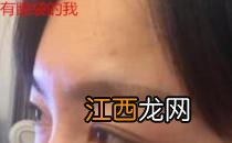 卫娅日记:我一直都以为眼袋对我的影响只是美观,直到我了解以后……