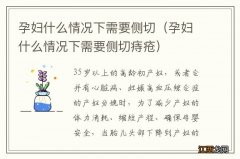 孕妇什么情况下需要侧切痔疮 孕妇什么情况下需要侧切