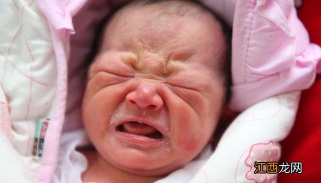 “丑宝宝”被全家人嫌弃,医生却说孩子颜值很高,一个月后奇迹了