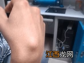 腱鞘囊肿能买医疗险吗？