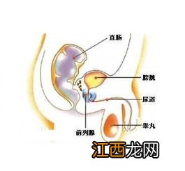 慢性前列腺炎能买重疾险吗？