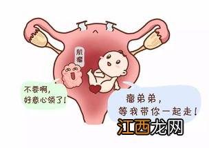 子宫肌瘤保险能赔付吗？