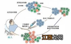 造血干细胞移植保险给报吗？